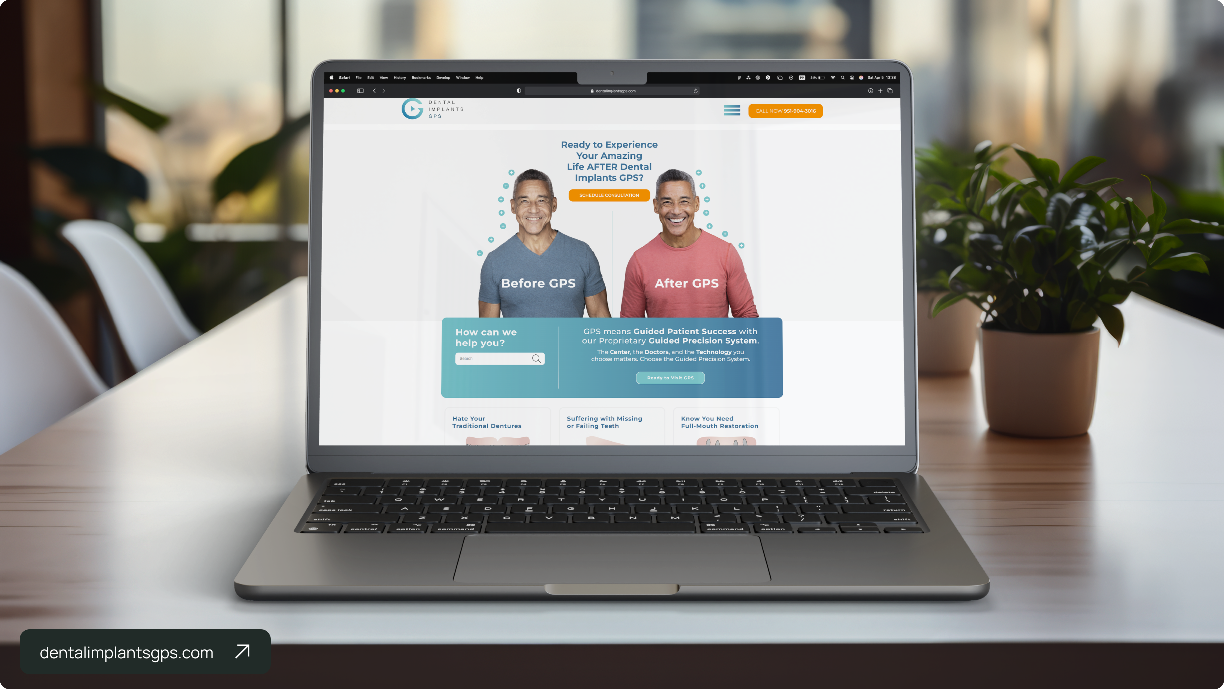 Dental Implants GPS website